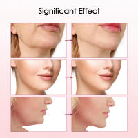 Masajeador Facial EMS Levantador De Pecho Doble V Con Luz Roja Y Azul LED Dispositivo De Cuidado De La Piel Para Adelgazamiento Y Tonificación Facial - details 8
