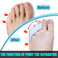 Pexmen Corrector De Bollo 2 Piezas Separador De Dedos Del Pies Protector De Dolor Corregidor De Dedos Herramienta De Cuidado Del Pie - details 1