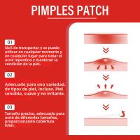 240Pcs Parches De Acné De Alta Gama Forma De Corazón Y Estrella Para Cubrir Erupciones Cutáneas Y Puntos Negros Parches Hidratantes Para El Rostro - details 2