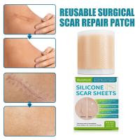 Cinta De Reparación De Marcas Silicone Gen 1 Para Rostro Y Cuerpo Eliminación De Acné Cuidado De La Piel Sin Electricity - details 4
