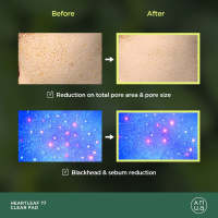 Heartleaf 77% Toner Clear Pad - details 1