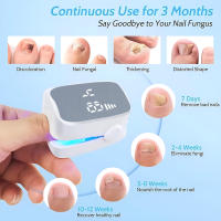 Dispositivo Láser Portátil Para El Tratamiento De La Onicomicosis Herramienta Antifúngica Para Uñas Y Dedos Recargable Por USB - details 1