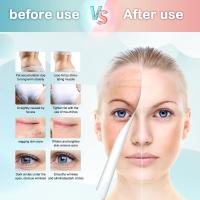 Cecodadi-40Khz Radiofrecuencia Cavitación Producto De Belleza, 6 En 1 Anticelulítico Celulitis Masajeador Facial Levantamiento De Cuerpo Conformado Adelgazamiento Máquina para Quemar Grasa Instrument, cintura, muslo, cadera, pierna - details 13