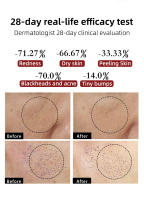 Bosidin RF Masajeador Facial EMS Lifting Facial Anti-envejecimiento Terapia De Luz LED Antiarrugas Dispositivo De Belleza Multi-polos Caliente Frío De Cuidado De La Piel - details 5