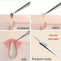 1 Pack Agujas Finas Para Remover Acné Y Blackheads Herramientas De Belleza Facial Para Cuidado De La Piel Tamaño No. 5 - details 7
