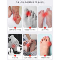 Calcetines Correctores De Hallux Valgus 1PCS Comodidad Transpirable Soporte No Eslipiente Al Amor Del Día Y La Noche Alivio Del Dolor Del Pie Mayor - details 2
