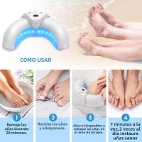 Dispositivo Láser KTS Para El Tratamiento De Hongos En Uñas De Los Pies Y Manos 12x470nm 6x910nm Con Pantalla De Tiempo 2000mA Portátil Y De Fácil Uso - details 2