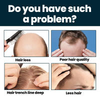 1 juego de suero para el crecimiento del cabello, tratamiento fortalecedor del crecimiento del cabello para hombres, tratamiento fortalecedor del crecimiento del cabello para el adelgazamiento del cabello y la caída del cabello - details 5