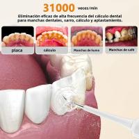 Cepillo De Dientes Eléctrico Sonic - Cuidado Y Eliminación De Calculo Portátil Para El Hogar Con 4 Cabezales De Reemplazo Incluidos - details 7