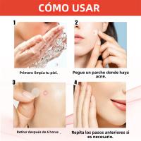 240Pcs Parches De Acné De Alta Gama Forma De Corazón Y Estrella Para Cubrir Erupciones Cutáneas Y Puntos Negros Parches Hidratantes Para El Rostro - details 6