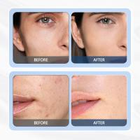 Instrumento De Belleza Ultrasonido Para Reafirmar La Piel Masajeador De Cara De Alta Frecuencia Anti Envejecimiento Eliminación De Manchas Herramienta De Cuidado De La Piel - details 12