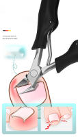 Alicate De Corte Para Uñas Y Cutículas Afilado Herramienta De Eliminación De Piel Muerta Para Pedicura Y Manicura - details 1