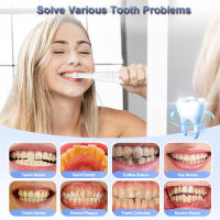 Limpia Tartar Dental Ultrasonica Limpiador De Placa Y Calcular Electrico Blanqueador De Dientes Eliminador De Tartar - details 2