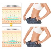 Máquina De Líposucción EMS VE Sport Masajeador Anticelulitis Para Cuerpo Shaping Quemagrasa Para Piernas Brazos Y Abdomen Equipo De Pérdida De Peso Fitness - details 17