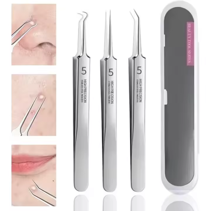 Pinzas para quitar puntos negros, pinzas profesionales para quitar puntos negros del rostro, herramienta de acero inoxidable para quitar puntos negros y comedones, para quitar imperfecciones y puntos blancos - 1