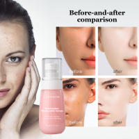 Suero, Suero de niacinamida de sandía, Gotas hidratantes e iluminadoras de niacinamida de sandía, Suero facial con ácido hialurónico, glicerina y vitamina E, Abrillantador líquido - details 8