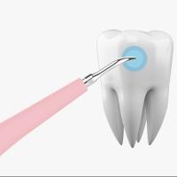 Limpieza Dental Eléctrica Portátil Escáner Sonic Calce Y Manchas De Calcio Eliminador Herramienta Blanqueamiento De Dientes Higiene Oral Para Adultos - details 2