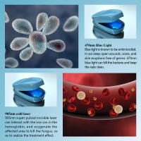 Dispositivo De Láser Para Tratamiento De Uñas Fungosas Azul 7 Minutos Tratamientos Sin Dolor Curación De Onicomicosis Máquina 905nm LLLT Para Uñas Y Dedos - details 3
