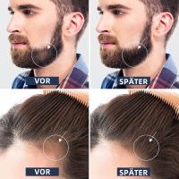 Dermaroller para Cabello y Piel-0.5 mm, Microneedling Profesional para Rostro y Cuerpo, Antiedad y Crecimiento Capilar - details 2