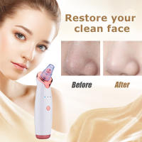 Removedor eléctrico de espinillas instrumento de belleza para el hogar limpiador de poros instrumento de belleza instrumento de exportación instrumento de succión de espinillas blanco - details 4