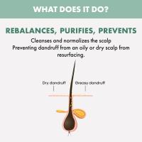 Alfaparf Sdl Scalp Rebalance Sebum Control Shampoo 1000Ml - details 1