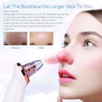 Limpiador De Poros Con Remover De Quistes Y Acné USB Recargable Herramienta De Cuidado De Piel Con Dermaabrasión Diamante Para Nariz - details 1