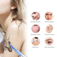 Láser Picosegundo Portátil Para Tratamiento De Tatuajes Manchas Y Acné Herramienta De Belleza Para Eliminación De Pigmentos Metal Hand Made - details 4
