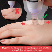 Máquina De Cuidado De La Piel Digital Para Eliminar Acné Y Quemaduras De Puntos Negros Con Microdermabrasión Y Vacío Herramienta Profunda Limpieza De Poros - details 11