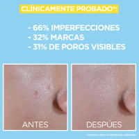 Garnier Pure Active Fluido UV Diario con BHA + Niacinamida FPS50+ - details 2