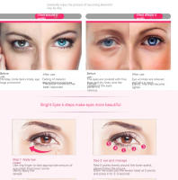 Instrumento De Belleza Eléctrico Para Massaje De Ojos Reducción De Arrugas Y Bagatelas De Piel Exquisito Cuidado De Los Ojos - details 5