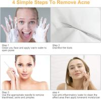 Kit Profesional De 9 Piezas Para Eliminar Quistes Y Puntos Negros Con Pinzas De Acero Inoxidable Y Estuche De Viaje Para Extractor De Acné Para Rostro Y Nariz - details 5