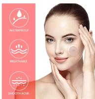 200pcs Parches De Reparación Para Acné Facial Cuidado De La Piel Elimina Manchas De Espinillas Y Acné Parches Para Cubrir Y Reparar - details 8
