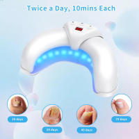 Dispositivo De Tratamiento Con Láser Para Uñas Fungosas Alextrasza Elimina Eficazmente La Onicomicosis En Uñas De Los Dedos Y Pies - details 4