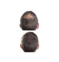 FIBRAS CAPILARES MEDIUM BROWN  FOR HAIR PROFESSIONAL MY HAIR - details 2