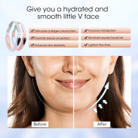 Cinturón Levantador De V Forma Para Rostro Con Masajeador Levantador De Piel Vibration 5 Modos Control Remoto Dispositivo De Cuidado De Piel - details 7