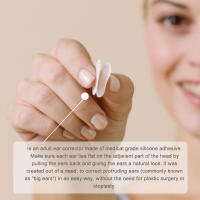 Corrector De Oreja Auricle Valgus Veneer Soporte Vertical Para Rostro V Invisibles Piel Sin Dolor Impermeable Estilo Fotográfico Para Corrección De Orejas Pequeñas - details 7