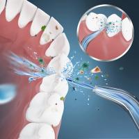 Limpia Dientes Portátil Sin Cable Ortoirrigador Aparato De Higiene Dental Recargable Para Adultos Limpiador De Encías - details 4