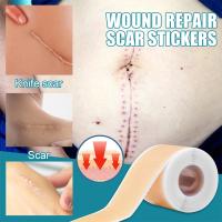 Cinta De Reparación De Marcas Silicone Gen 1 Para Rostro Y Cuerpo Eliminación De Acné Cuidado De La Piel Sin Electricity - details 5