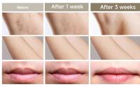 Epilador Laser IPL Para Mujeres Trimmer Afeitadora Remover Mower Afeitadora Eléctrica Bikinis Razor Gimnasio Máquina De Corte De Pelo - details 15