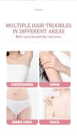 Epilador Eléctrico Para Mujer 4 En 1 Trimmer De Cabello Painless Portátil Adecuado Para Axilas Piernas Brazos Cara Y Barba - details 3