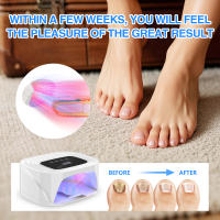 Dispositivo De Láser Para Uñas 20W Carga Inalámbrica Pantalla Digital Luz Roja 24*650NM + Luz Azul 12*470NM Para Limpieza De Onicomicosis Jitesy S15 - details 5