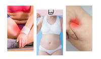 6-2Pcs Almohadillas De Pierna Antifricción Absorción De Sudor Invisibles Alivio Del Dolor Deporte Al Aire Libre Cuidado Del Cuerpo Anti-desgaste - details 1