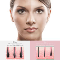 Cepillo De Limpieza Facial Ultrasonido Eléctrico Multifuncional 2 En 1 Profesional De Silicona MIKO NICE Para Un Cuidado Facial Eficaz - details 3