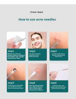 Juego De 6 Piezas De Agujas De Acné En Acero Inoxidable Herramienta De Belleza Para Eliminar Quistes Y Puntos Negros - details 15