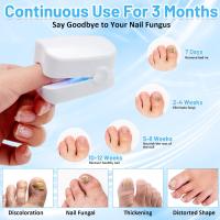Dispositivo de Tratamiento de Hongos en las Uñas, Aparato de Tratamiento Láser de Hongos de Uñas Hongos de Uñas de Los pies Limpieza Reparación de Uñas Tratamiento de Hongos de Uñas. - details 2