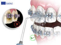 Irrigador Dental Aquapik 100 + Pasta Dental Blanqueadora Opalescence de Regalo - details 2