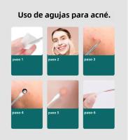 Juego De 4 Herramientas Para Eliminar Quistes Y Puntos Negros En La Piel Limpiador De Poros Set De Herramientas De Cuidado De La Piel - details 3