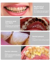 Cepillo de dientes eléctrico con limpieza Sónica, 3 en 1, para eliminar el sarro, blanquear los dientes, cuidado bucal, carga USB, cabezal de reemplazo - details 2