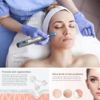 Dr. Pen Ultima M8S Wireless Profesional Derma Pen Para Crecimiento Del Cabello Con 2 Agujas Terapia Microneedle Anti-Backflow Micro Pen - details 1
