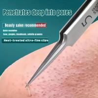 Tijeras Para Eliminar Quistes De Acné De Acero Inoxidable Herramientas Eficientes Para Extracción De Comedones Y Quistes Blancos Limpieza Profunda Del Piel - details 7
